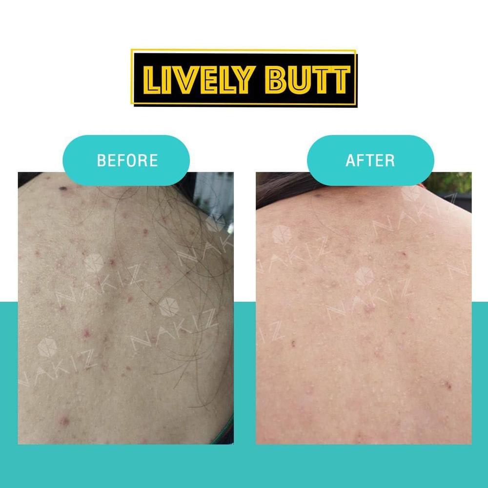 Nakiz Lively Butt Cream